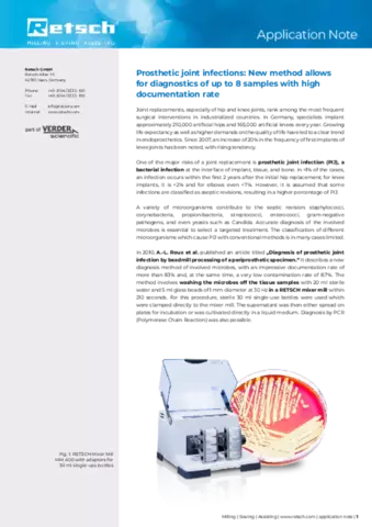 Endoprosthetics MM400